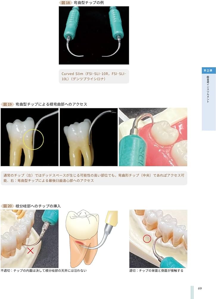【裁断済】ペリオドンタル・デブライドメント 超音波”を攻略せよ ペリオドンタル・デブライドメント: プラス1 | 大野